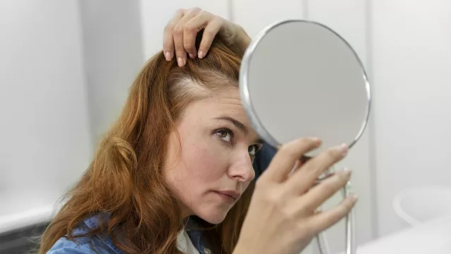 La caída capilar no empieza en el pelo